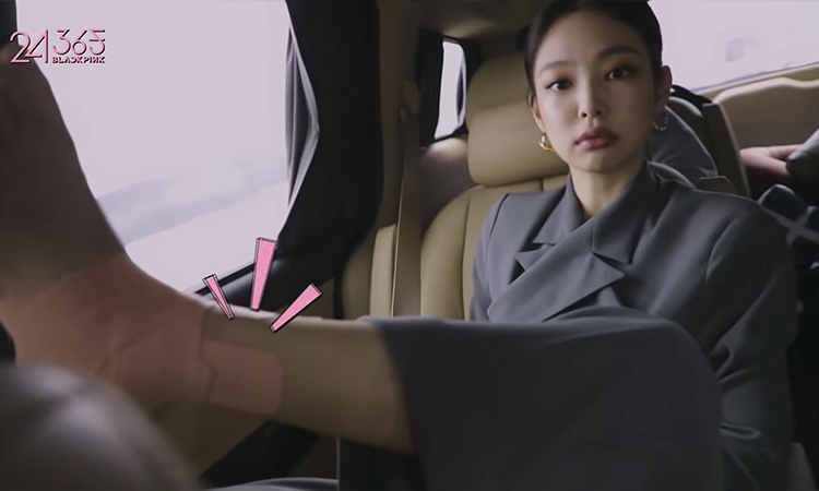 BLINK está preocupado por el tobillo lesionado de Jennie de BLACKPINK
