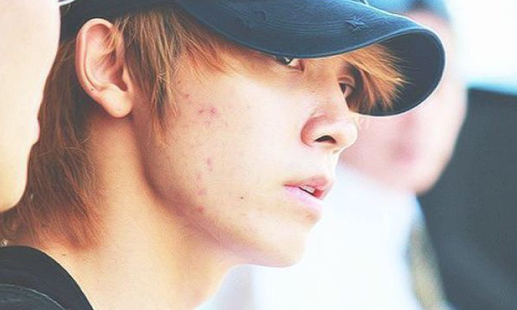 Dermatólogos especializados en el K-Pop explica cómo las dietas de los idols afectan su piel