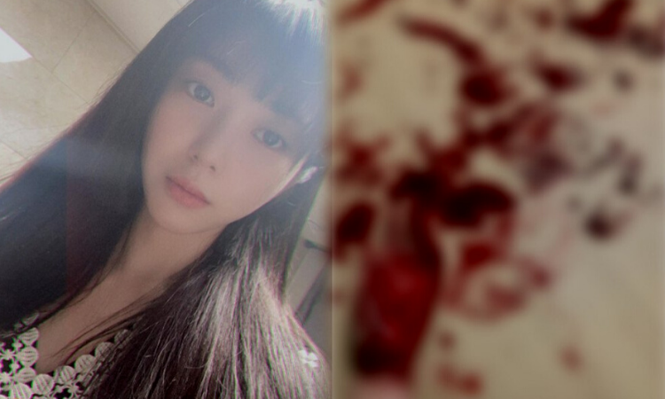 Mina ex AOA compartilha uma maldita foto de auto-flagelação em sua conta Instagram