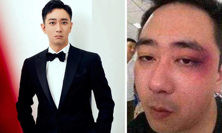 Artistas chinos que han sido víctimas de violencia doméstica